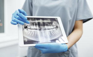 Dental X-Rays