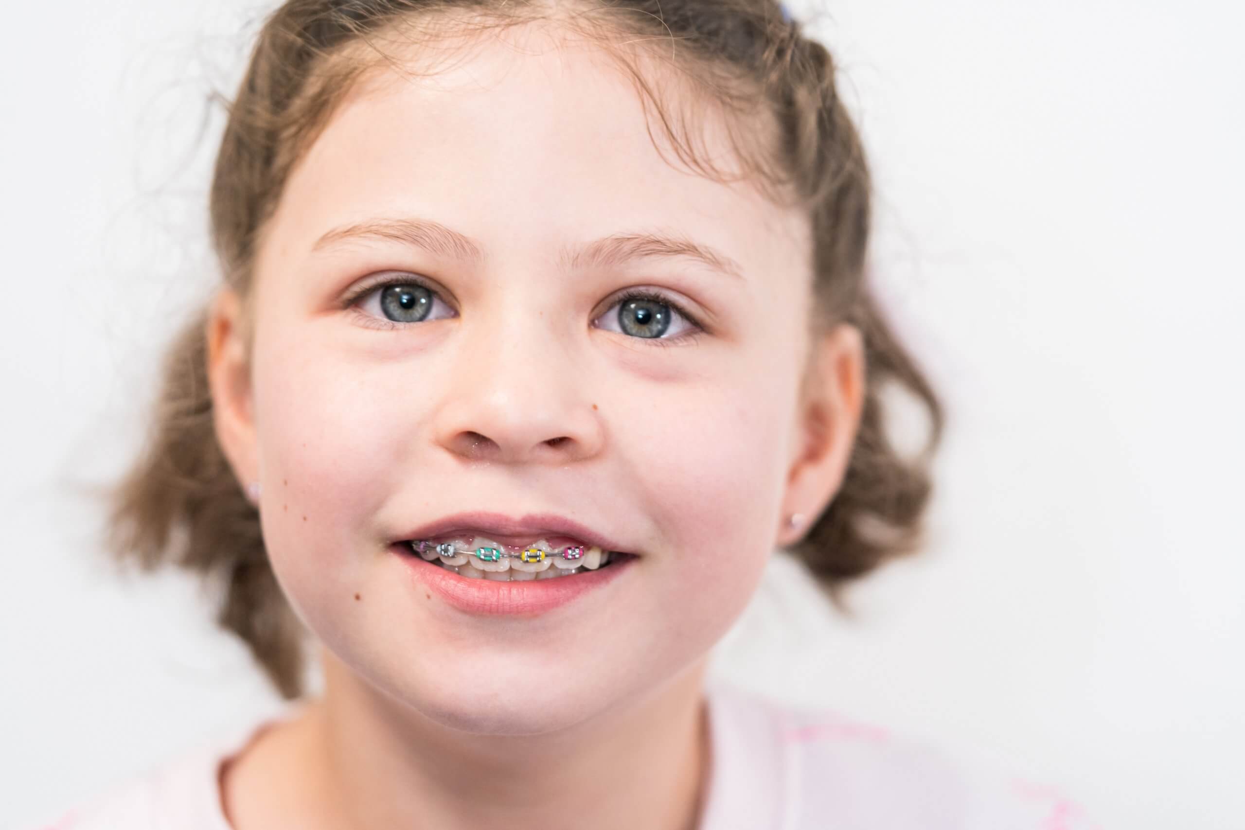 Little,girl,with,rainbow,braces,smiling,at,the,camera.